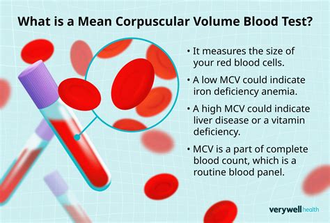 MCV (Mean Corpuscular Volume): MedlinePlus Medical Test